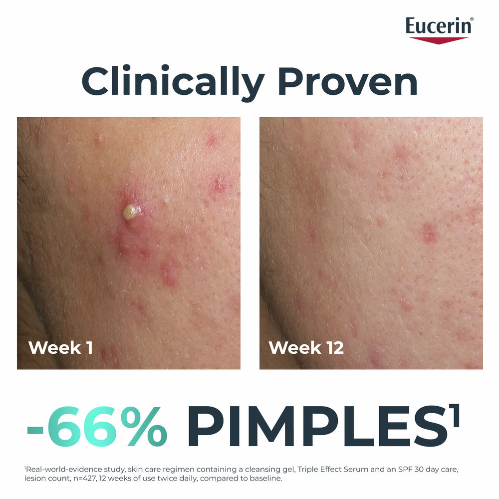 EUCERIN DERMOPURE TRIPLE ACTION FLUID 40ML